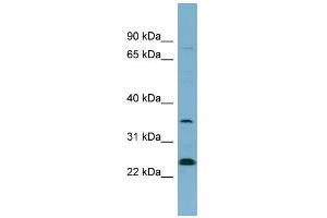 WB Suggested Anti-NOSIP Antibody Titration: 0. (NOSIP anticorps  (N-Term))