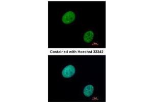 ICC/IF Image Immunofluorescence analysis of paraformaldehyde-fixed HeLa, using GLI3, antibody at 1:500 dilution.