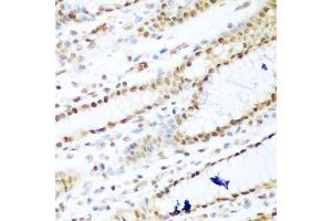 Immunohistochemistry of paraffin-embedded human stomach using HDAC1 antibody. (HDAC1 anticorps  (AA 393-482))
