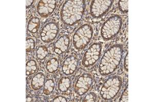 IHC analysis of TST using anti-TST antibody (ABIN7599105). (TST anticorps  (AA 1-220))