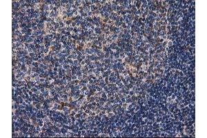 Image no. 15 for anti-Destrin (Actin Depolymerizing Factor) (DSTN) antibody (ABIN1497910) (Destrin anticorps)