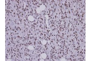 IHC-P Image Immunohistochemical analysis of paraffin-embedded Saos-2 xenograft, using SF3B3 , antibody at 1:100 dilution.