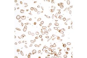 Immunocytochemistry (ICC) image for anti-Cadherin 2 (CDH2) (AA 160-724) antibody (ABIN7453333)
