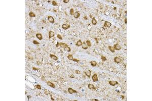 Immunohistochemistry of paraffin-embedded rat brain using p70 S6 Kinase 1 1 Rabbit pAb (ABIN7270029) at dilution of 1:100 (40x lens).