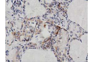Immunohistochemistry (IHC) image for anti-Peroxisomal Trans-2-Enoyl-CoA Reductase (PECR) antibody (ABIN1500148)