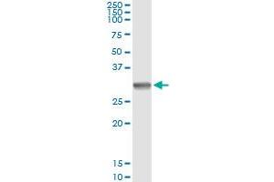 Immunoprecipitation of SNAI1 transfected lysate using anti-SNAI1 monoclonal antibody and Protein A Magnetic Bead , and immunoblotted with SNAI1 MaxPab rabbit polyclonal antibody.