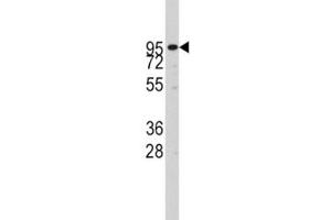 Western blot analysis of ADAM17 antibody and CEM lysate