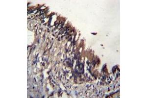 Immunohistochemistry analysis in formalin fixed and paraffin embedded human lung tissue reacted with NUDT9 / NUDT10 (C-term)  Antibody  followed by peroxidase conjugation of the secondary antibody and DAB staining. (NUDT9 anticorps  (C-Term))