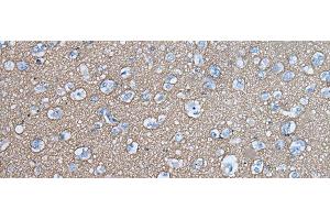 Immunohistochemistry of paraffin-embedded Human brain tissue using SNCB Polyclonal Antibody at dilution of 1:45(x200) (beta Synuclein anticorps)