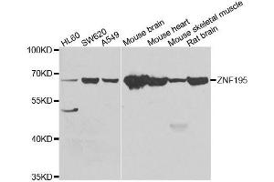 Western blot analysis of extracts of various cell lines, using ZNF195 antibody. (ZNF195 anticorps  (AA 1-250))