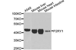 Western blot analysis of extracts of various cell lines, using P2RY1 antibody. (P2RY1 anticorps  (AA 274-373))