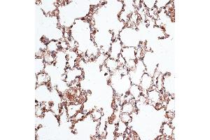 Immunohistochemistry of paraffin-embedded mouse lung using Vimentin antibody (ABIN3016291, ABIN3016292, ABIN3016293 and ABIN6219693) at dilution of 1:100 (40x lens). (Vimentin anticorps  (AA 1-200))