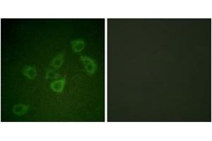 Immunofluorescence analysis of HuvEc cells, using Caspase 6 (Phospho-Ser257) Antibody. (Caspase 6 anticorps  (pSer257))