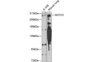 Western blot analysis of extracts of various cell lines, using MYO10 antibody (ABIN6128320, ABIN6144272, ABIN6144275 and ABIN6224500) at 1:1000 dilution. (Myosin X anticorps  (AA 845-944))