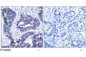 Image no. 1 for anti-Insulin Receptor Substrate 1 (IRS1) (pSer639) antibody (ABIN196981) (IRS1 anticorps  (pSer639))