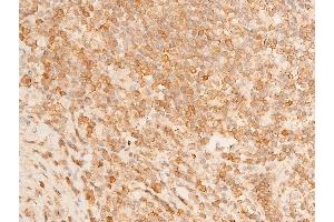 ABIN6267232 at 1/100 staining human appendiceal tissue sections by IHC-P.