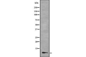 Western blot analysis of MLLT11 using COLO205 whole cell lysates