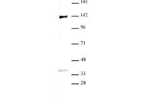 JMJD2B / KDM4B antibody (pAb) tested by Western blot. (KDM4B anticorps  (C-Term))