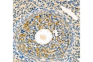 Immunohistochemistry of paraffin embedded rat ovary using SLBP (ABIN7075733) at dilution of 1: 700 (400x lens)