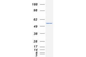 Validation with Western Blot