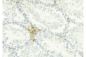ABIN6274454 at 1/100 staining Mouse testis tissue by IHC-P.