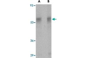 Western blot analysis of PLXDC1 in rat liver tissue lysate with PLXDC1 polyclonal antibody  at (A) 0. (PLXDC1 anticorps  (Internal Region))