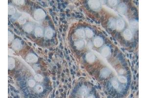 IHC-P analysis of Human Stomach Tissue, with DAB staining. (COL3A1 anticorps  (AA 1059-1466))