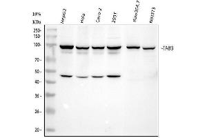 Western blot analysis of TAB3 using anti-TAB3 antibody (ABIN7606436).
