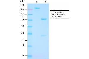 SDS-PAGE Analysis Purified FOLH1 Rabbit Recombinant Monoclonal Antibody (FOLH1/3149R). (Recombinant PSMA anticorps  (AA 232-433))