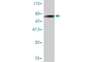 Western Blot detection against Immunogen (72. (KRT20 anticorps  (AA 1-424))