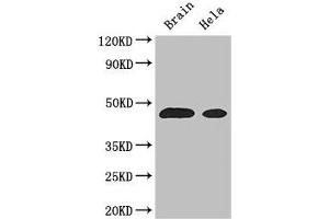 Western Blot Positive WB detected in: Mouse brain tissue, Hela whole cell lysate All lanes: ASS1 antibody at 3 μg/mL Secondary Goat polyclonal to rabbit IgG at 1/50000 dilution Predicted band size: 47 kDa Observed band size: 47 kDa (ASS1 anticorps  (AA 168-222))
