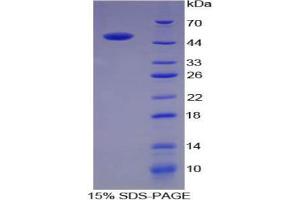 SDS-PAGE analysis of Pig ACE Protein. (Angiotensin I Converting Enzyme 1 Protéine)