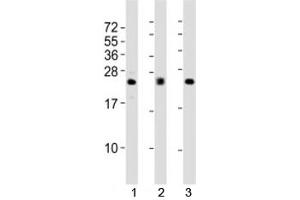 Western blot testing of FGF2 antibody at 1:2000 dilution (FGF2 anticorps)