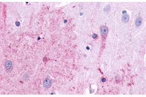 Anti-TACR3 antibody  ABIN1049390 IHC staining of human brain, neurons and glia. (TACR3 anticorps  (N-Term))