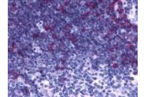 Immunohistochemistry (IHC) image for anti-Prostaglandin D2 Receptor 2 (PTGDR2) (C-Term) antibody (ABIN2469265)