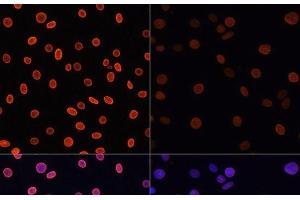 Immunofluorescence analysis of C6 cells using Acetyl-Histone H4-K91 Polyclonal Antibody at dilution of 1:100. (Histone H4 anticorps  (acLys91))