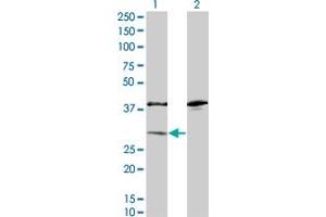 Western Blot analysis of SULT1A1 expression in transfected 293T cell line by SULT1A1 monoclonal antibody (M01A), clone 1F8. (SULT1A1 anticorps  (AA 1-295))