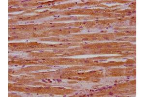 IHC image of ABIN7159742 diluted at 1:400 and staining in paraffin-embedded human heart tissue performed on a Leica BondTM system. (MACF1 anticorps  (AA 1936-2150))