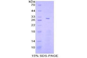 SDS-PAGE analysis of Human STAT4 Protein. (STAT4 Protéine)