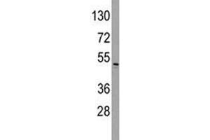 Western blot analysis of ILK antibody and HeLa lysate. (ILK anticorps  (AA 225-253))
