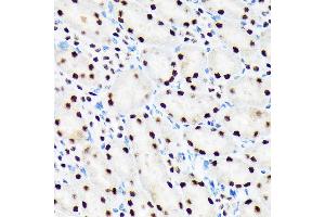 Immunohistochemistry of paraffin-embedded mouse kidney using PBRM1 Rabbit mAb (ABIN1512585, ABIN3020942, ABIN3020943 and ABIN7101308) at dilution of 1:100 (40x lens). (Polybromo 1 anticorps)