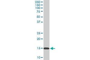 RPL36A monoclonal antibody (M02), clone 6H1. (RPL36A anticorps  (AA 7-106))