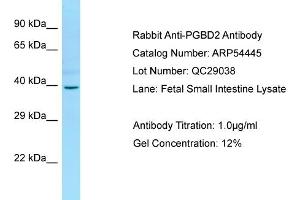 Western Blotting (WB) image for anti-PiggyBac Transposable Element Derived 2 (PGBD2) (Middle Region) antibody (ABIN2785716) (PGBD2 anticorps  (Middle Region))