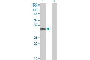 Western Blot analysis of CDK5R1 expression in transfected 293T cell line by CDK5R1 monoclonal antibody (M01), clone 4G11.