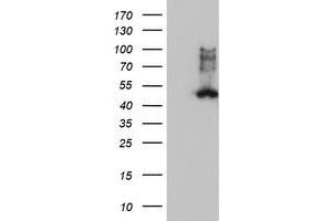 Western Blotting (WB) image for anti-Farnesyl-Diphosphate Farnesyltransferase 1 (FDFT1) antibody (ABIN1498243)