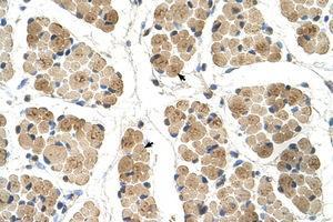 anti-Kelch-Like 31 (KLHL31) (AA 501-550) antibody