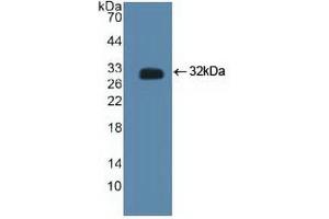 Western blot analysis of recombinant Human CTBP2. (CTBP2 anticorps  (C-Term))