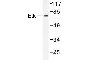 Image no. 1 for anti-BMX Non-Receptor Tyrosine Kinase (BMX) antibody (ABIN272021) (BMX anticorps)