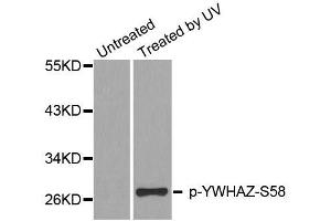 Western blot analysis of extracts from HeLa cells, using Phospho-YWHAZ-S58 antibody (ABIN2987575). (14-3-3 zeta anticorps  (pSer58))