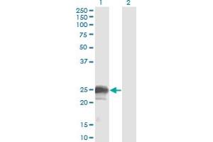 Western Blot analysis of NBL1 expression in transfected 293T cell line by NBL1 monoclonal antibody (M02), clone 1G5.
